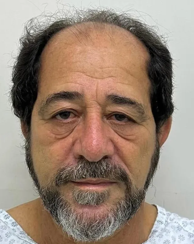 Müşteri 1 - Saç ekimi öncesi